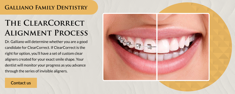 Galliano-Family-Dentistry-Graphic-1000×400-1