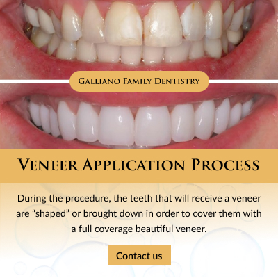 Galliano-Family-Dentistry-Graphic-400×400-1