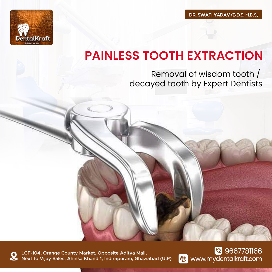 Best-Dentist-for-Tooth-Extraction-in-Indirapuram-for-Safe-Care