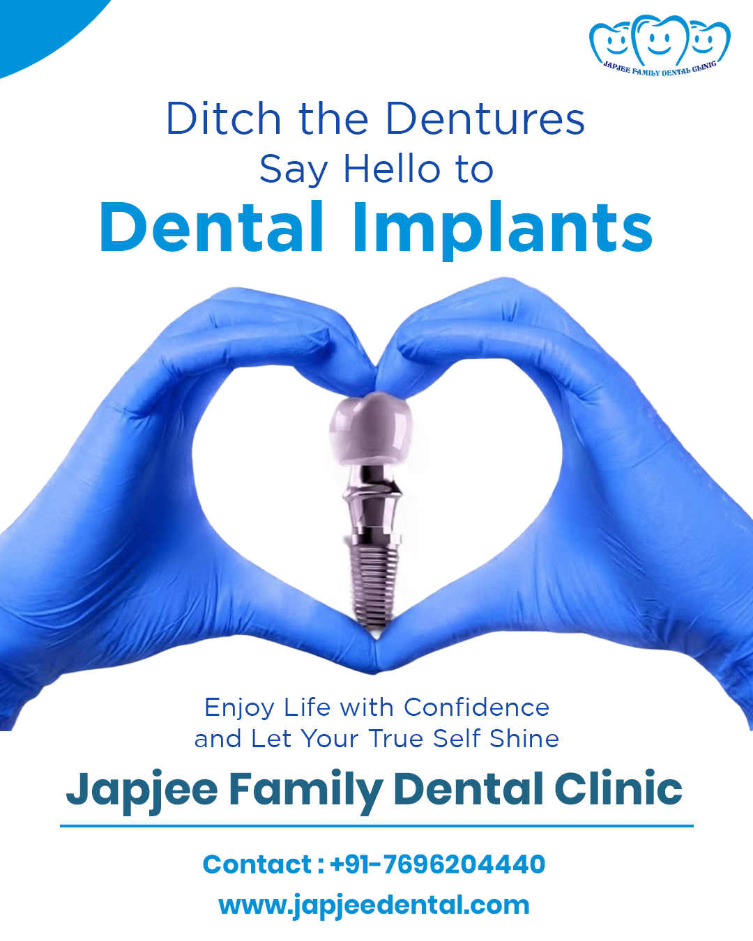 Dental-Implants