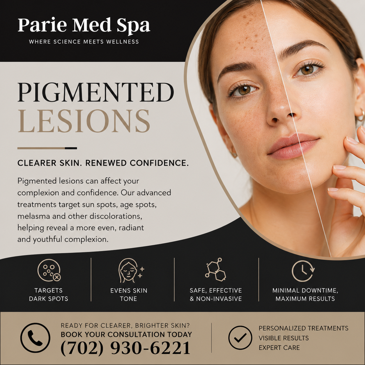 Pigmented-lesions-Treatment-by-Parie-Med-Spa