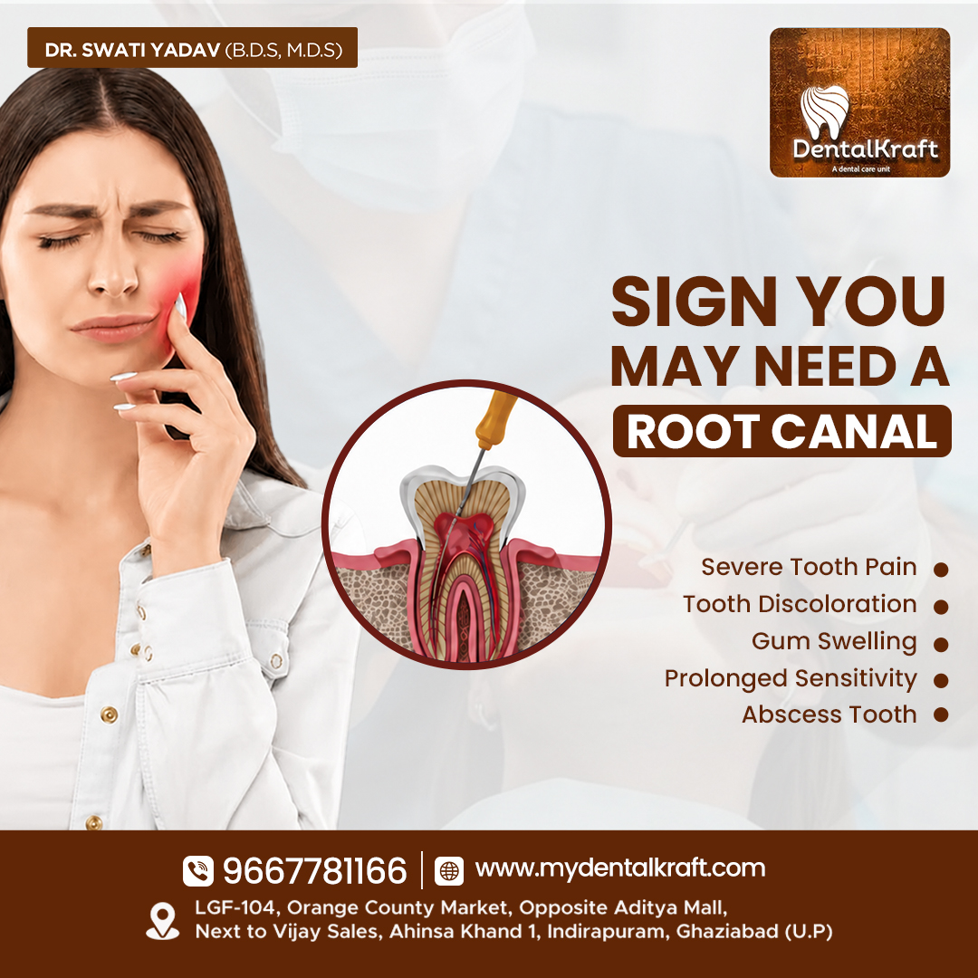RCT-Clinic-in-Indirapuram-Offering-Painless-Root-Canal-Treatment-1