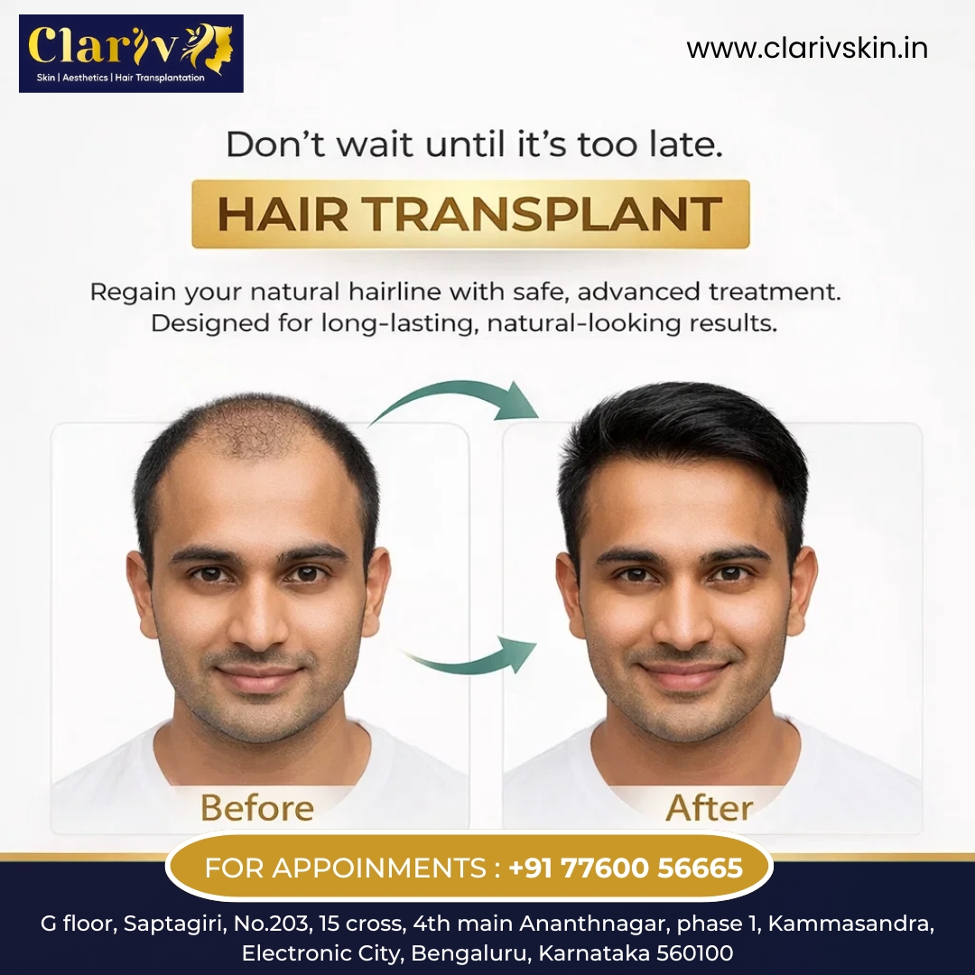 hair-transplant-clariv-skin-bangalore-before-after