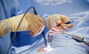 Laminectomy-Decompression
