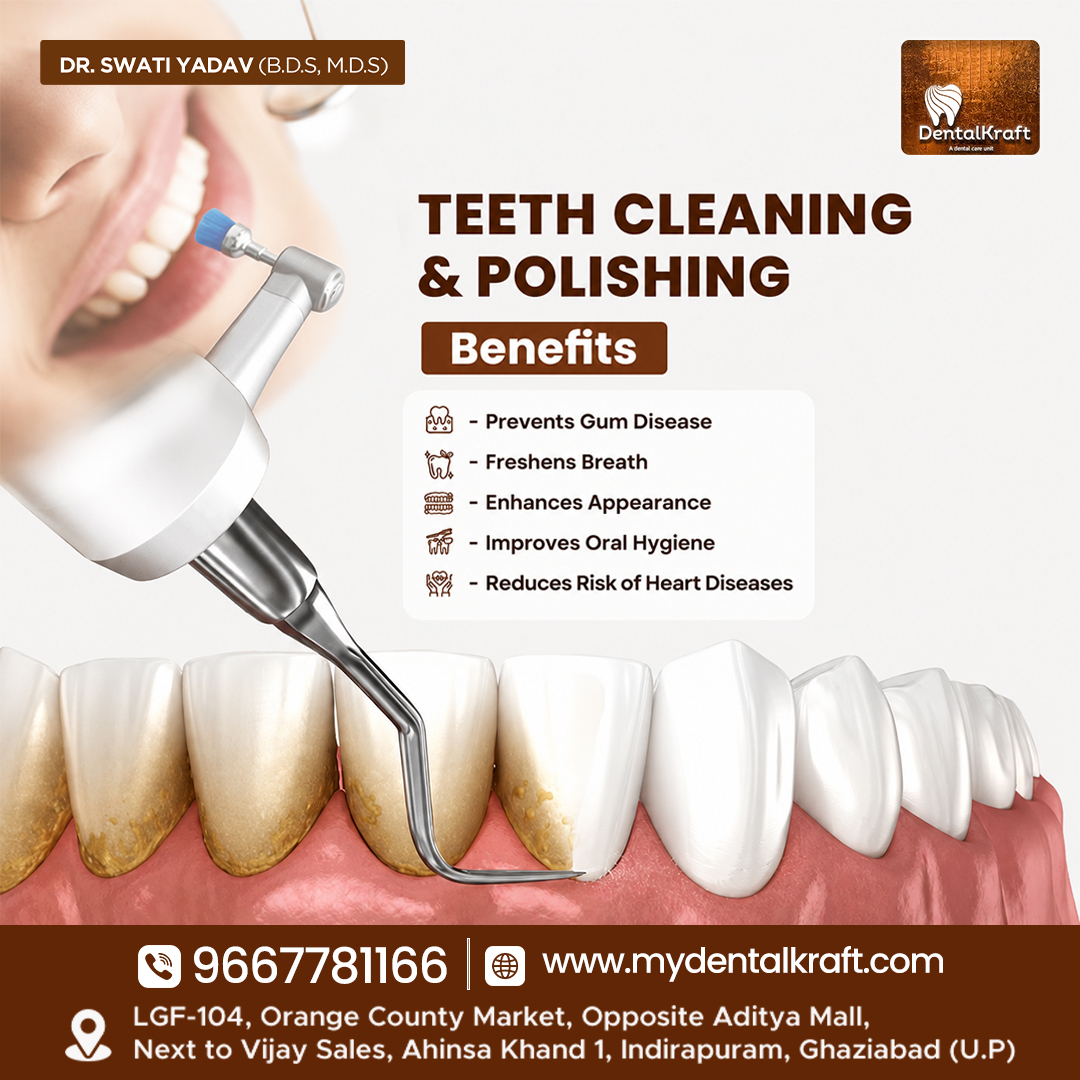 Teeth-Cleaning-in-Indirapuram-jpg