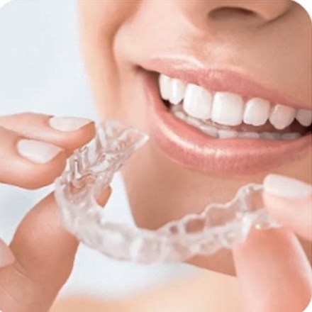 6-invisible-braces-new