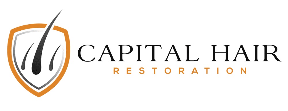 Capital-Hair-Restoration-01-copy-new