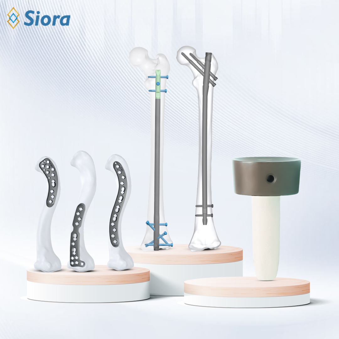 Interlocking-Nailing-Systems-Radial-Head-Prosthesis-Variable-Angle-Locking-Plate-Siora-Surgicals