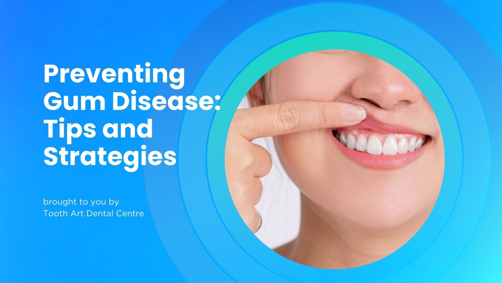 Week-10-Preventing-Gum-Diseases
