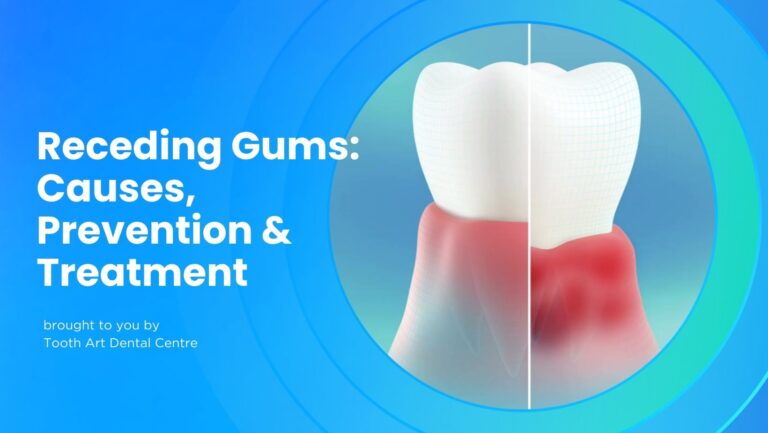 Week-12-Receding-Gums-768×433-1