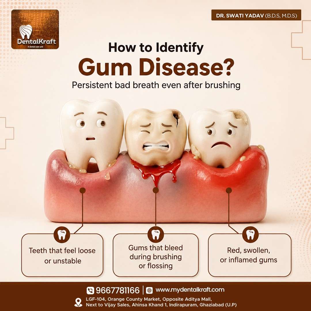 Dental-Kraft-Indirapuram-jpg