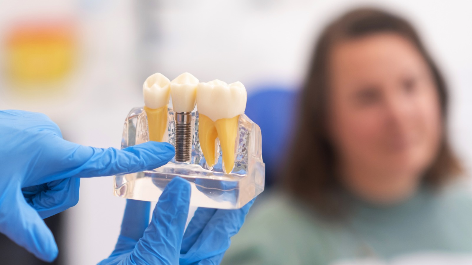 dental-implant-candidate