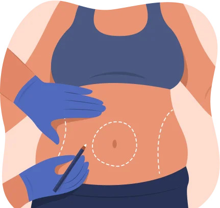 tummy-tuck