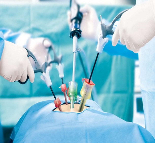 laparoscopic-surgery-in-hanamkonda