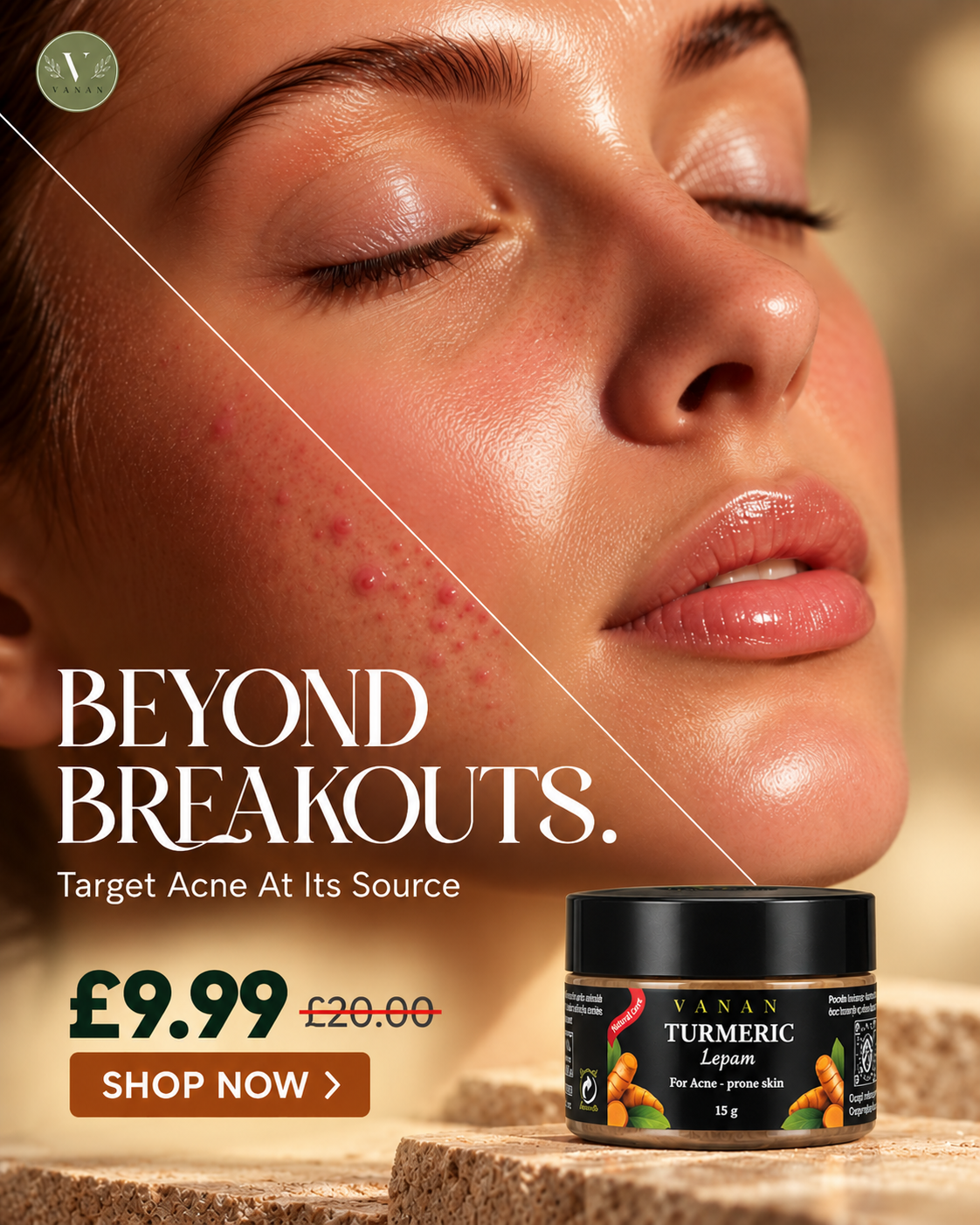 Beyond-Breakouts-Skincare-Ad