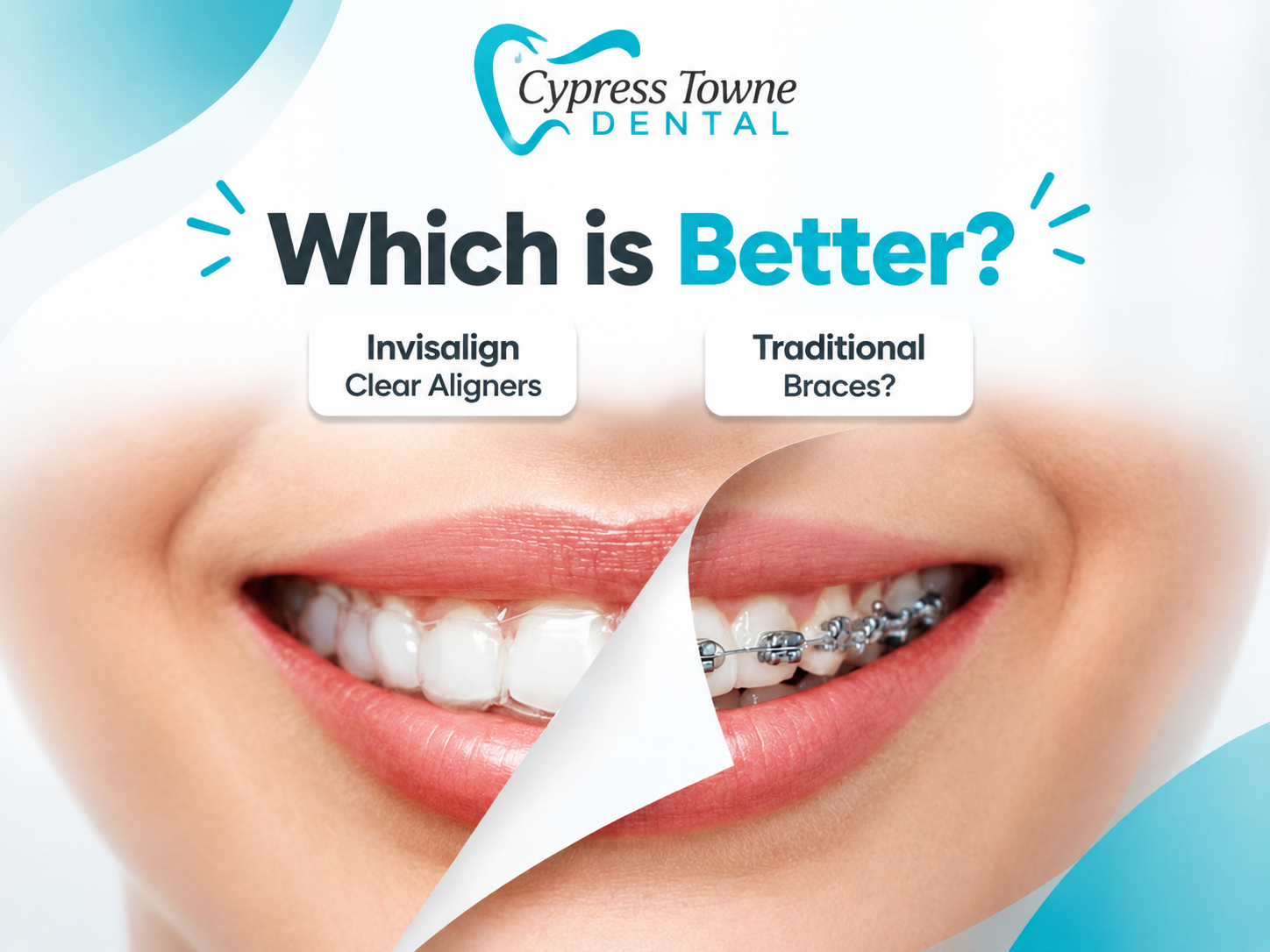 Invisalign-Clear-Aligners-vs.-Braces