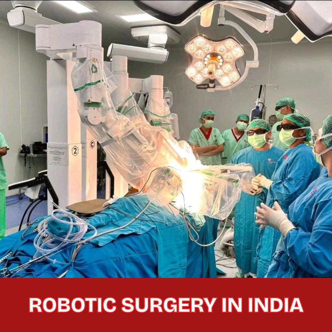 Robotic-Surgery-in-India