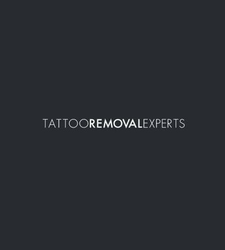 Tattoo-Removal-Experts-Logo